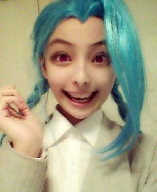 怎樣預(yù)防紅眼病 保護(hù)心靈的窗戶